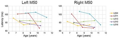 Maturation of Auditory Cortex Neural Activity in Children and Implications for Auditory Clinical Markers in Diagnosis